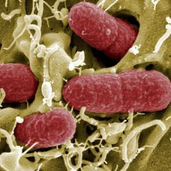 E. Coli 0104:H4