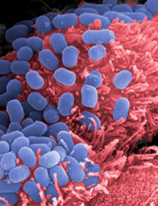 E. coli O157:H7